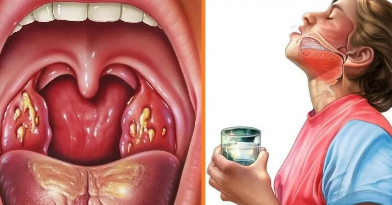 How to Manage Tonsillitis Pain While Eating