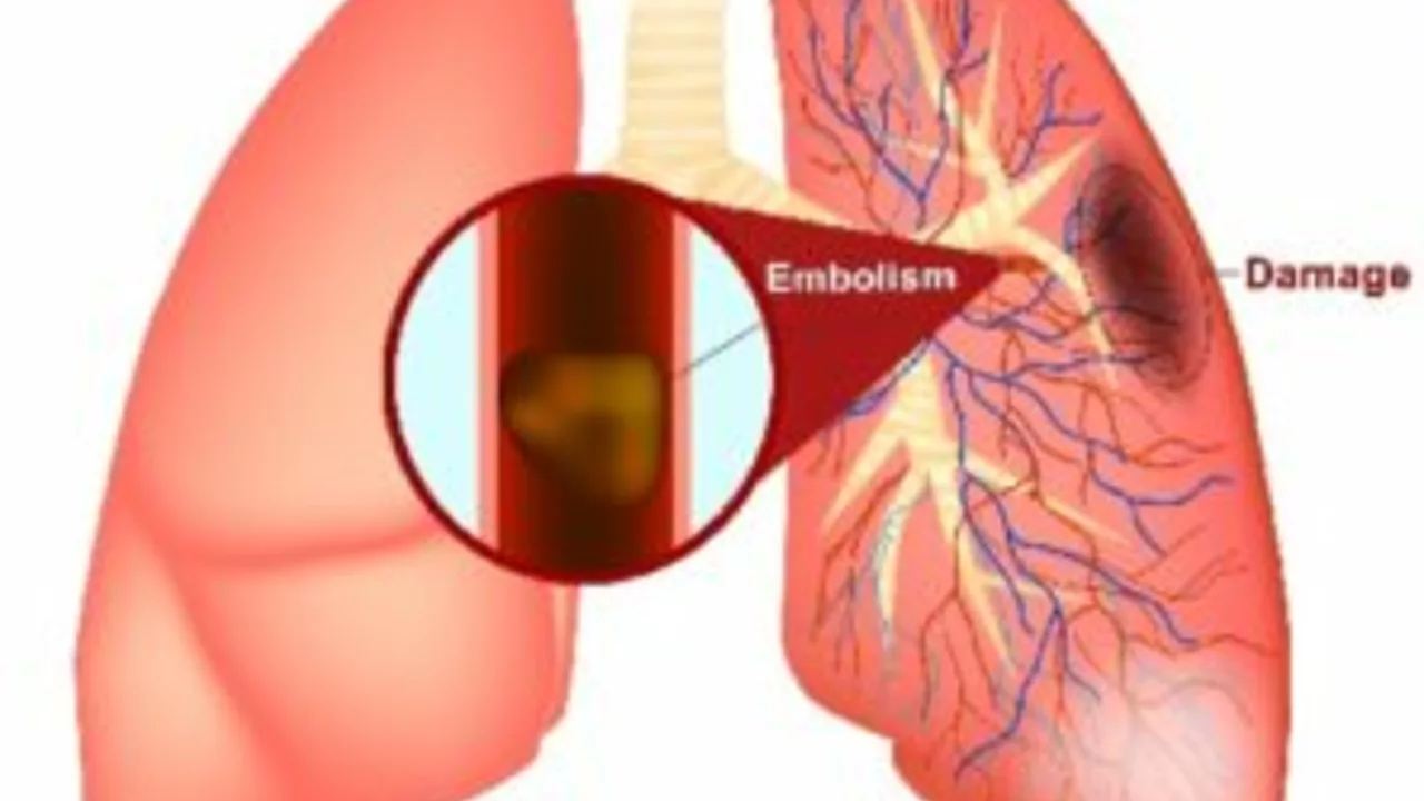 How to Support a Loved One Diagnosed with Pulmonary Embolism